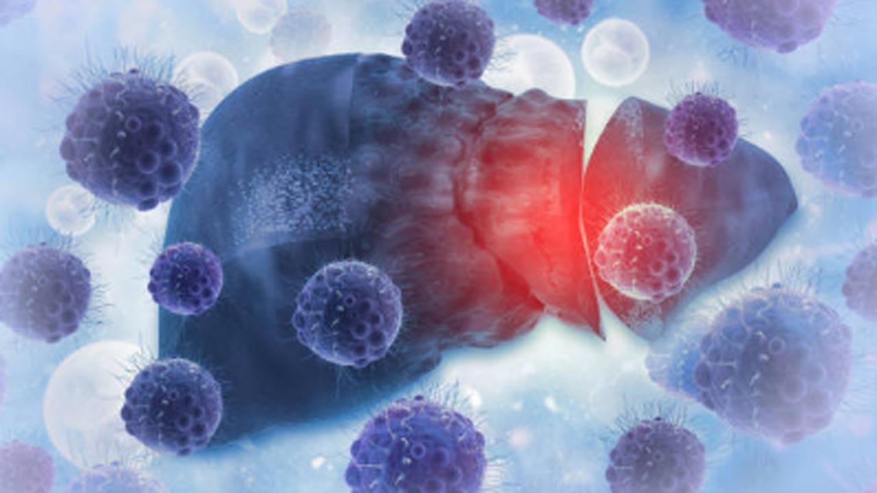World Cancer Day 2023: Liver cancer cases, deaths estimated to rise