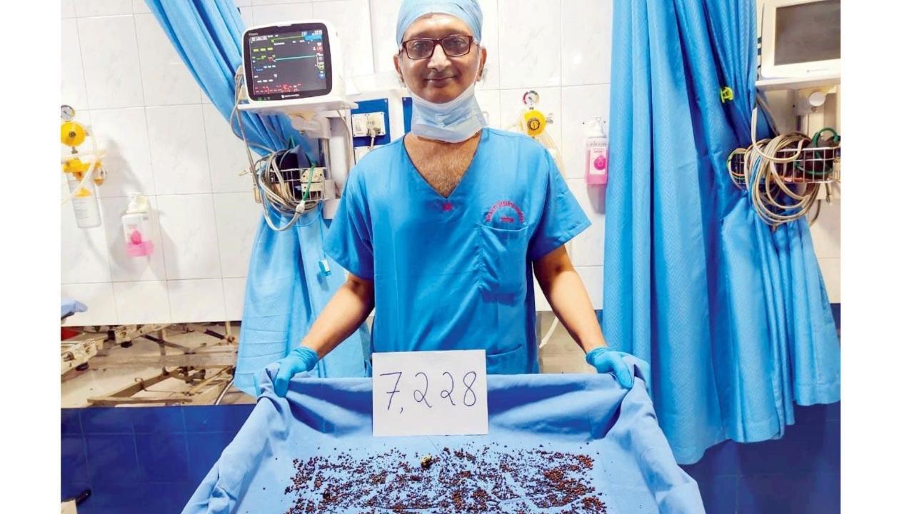 Mumbai: 7,228 gallstones removed from Mira Road woman