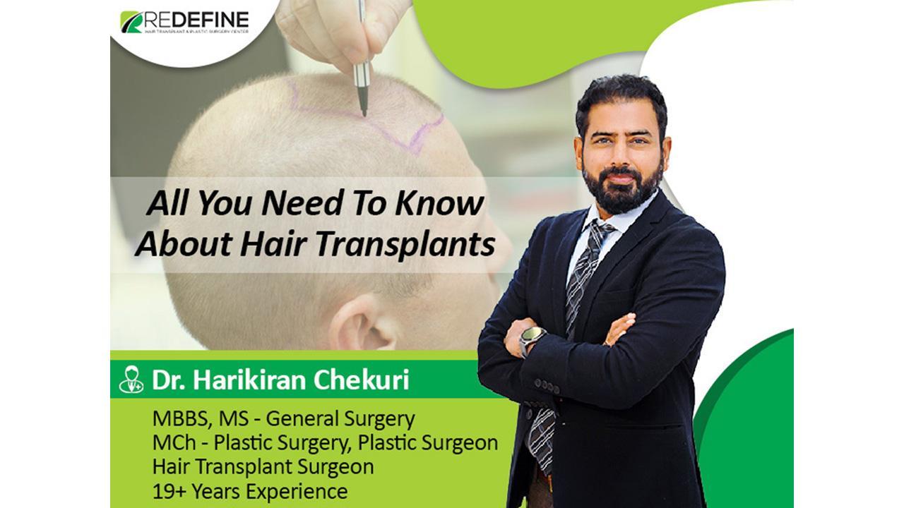 All you need to know about hair transplants