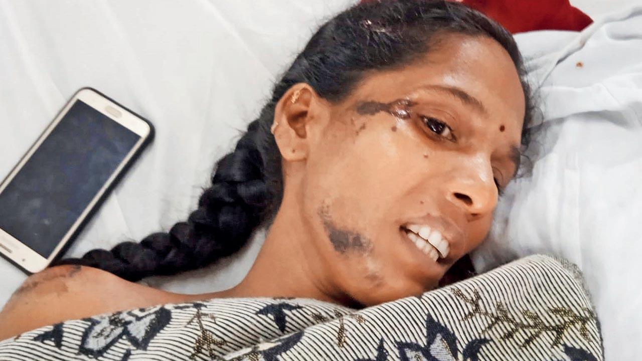 Sapna Sangare, one of two people severely injured in the accident
