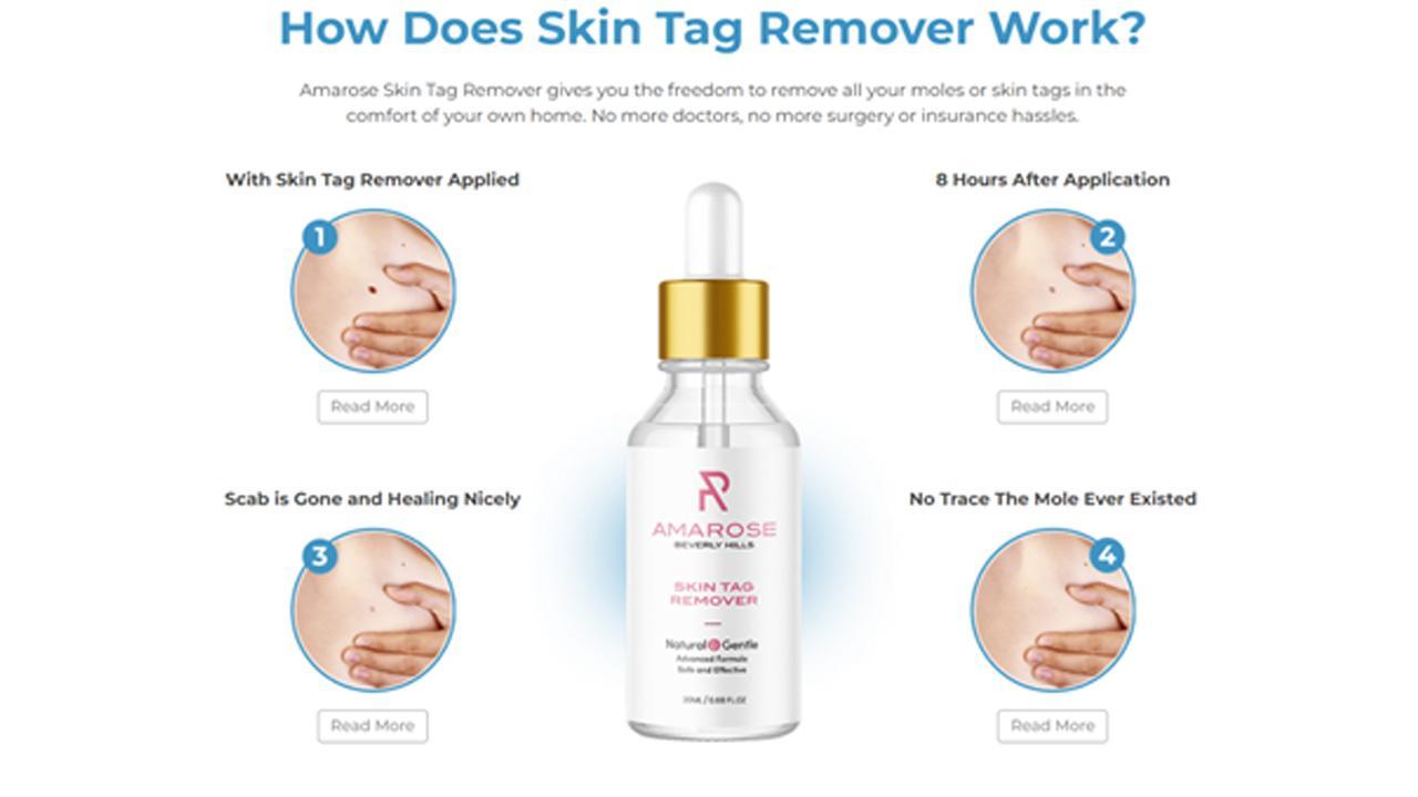 Amarose Skin Tag Remover Reviews | Perfect 10 Skin Tag Remover Reviews