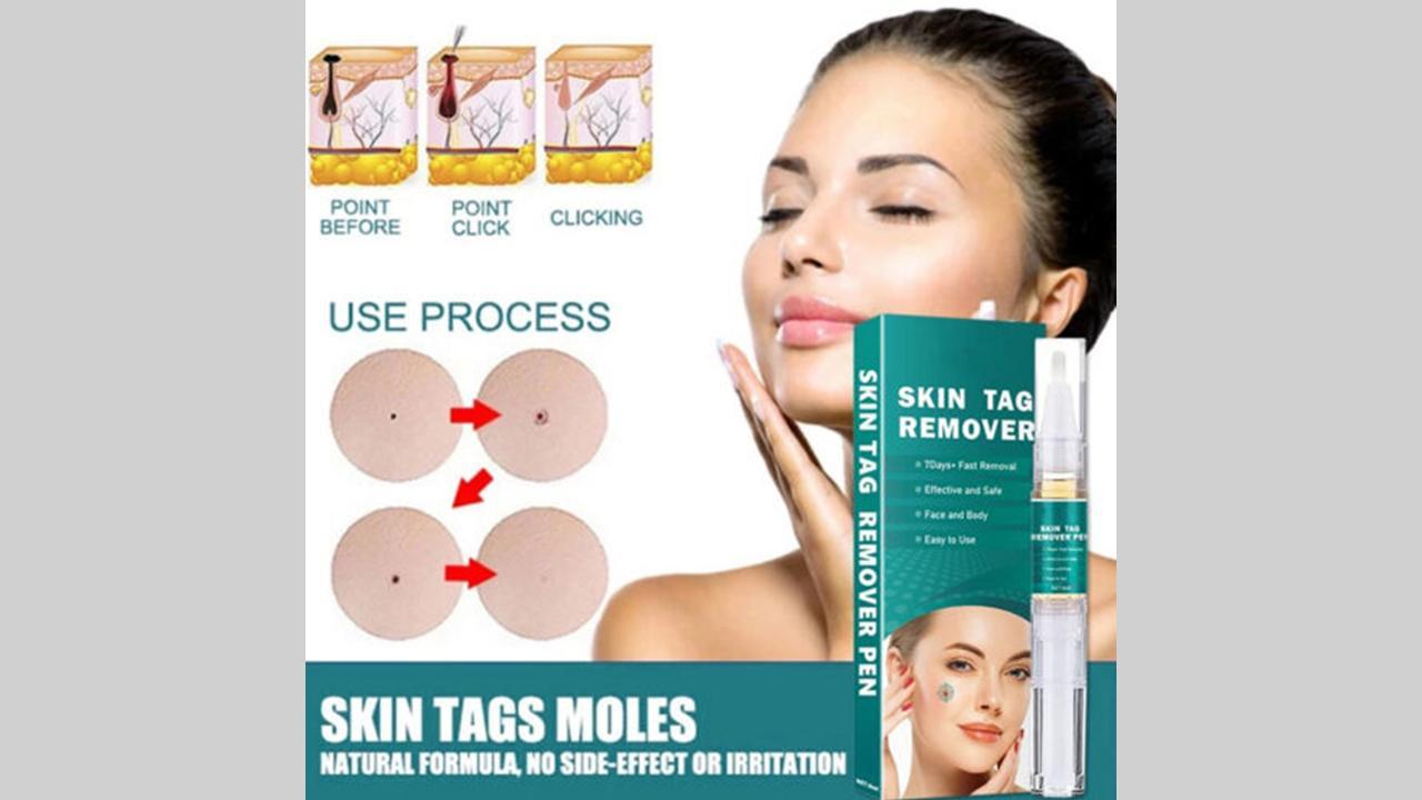 Dr Reilly Skin Tag Remover Reviews SCAM or LEGIT? Read Before Buy DR Reilly Skin Tag Remover!