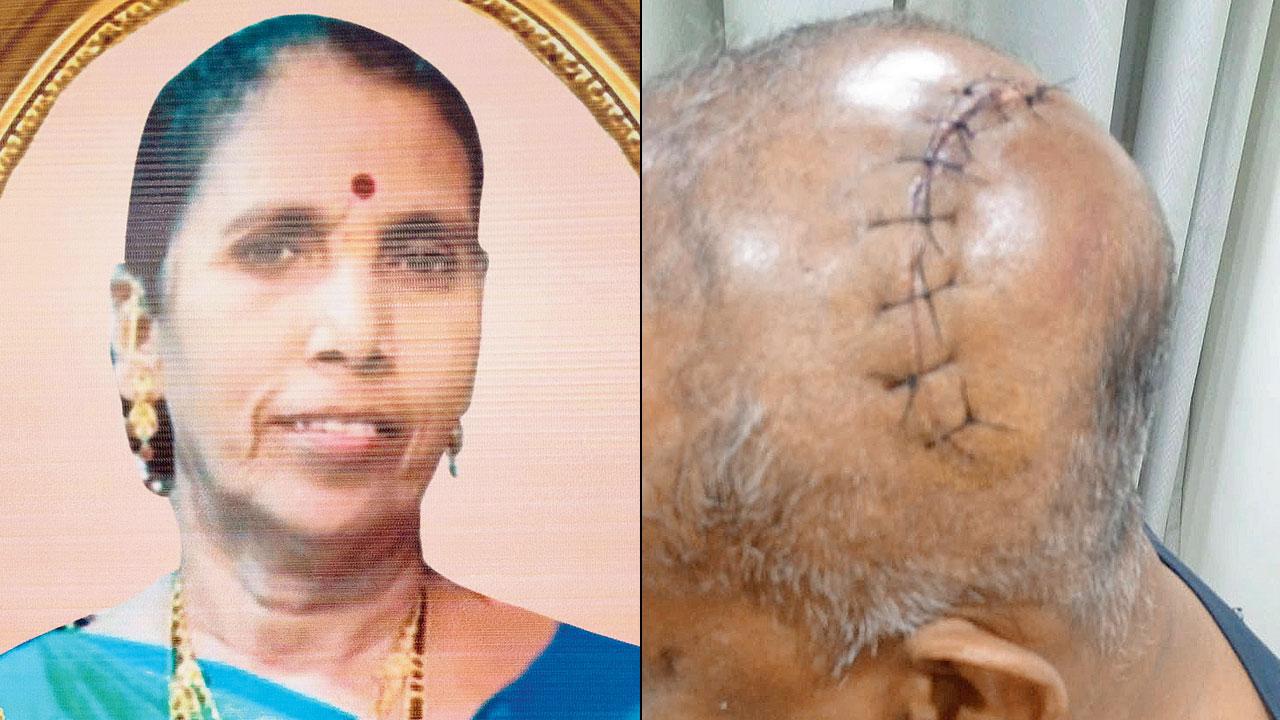 Renuka Koli, who had a heart attack in a pool at Chembur on April 4 (right) A M Shaikh received 26 stitches after an injury on February 26