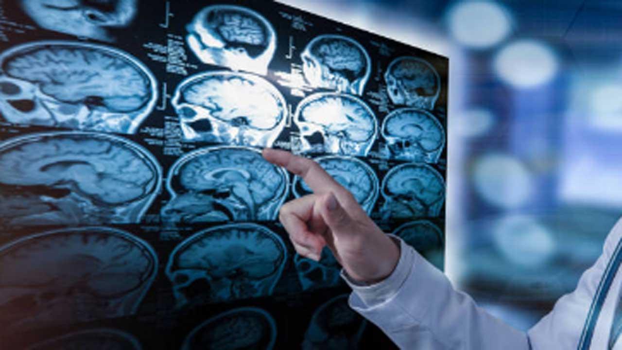New breakthrough technique may lead to early diagnosis of Parkinson's
