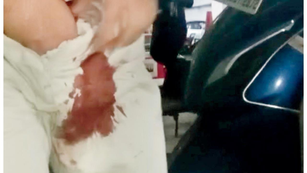 A GSD lunged at delivery agent Narendra Periyar last year at a housing society in New Panvel,  leaving him bleeding