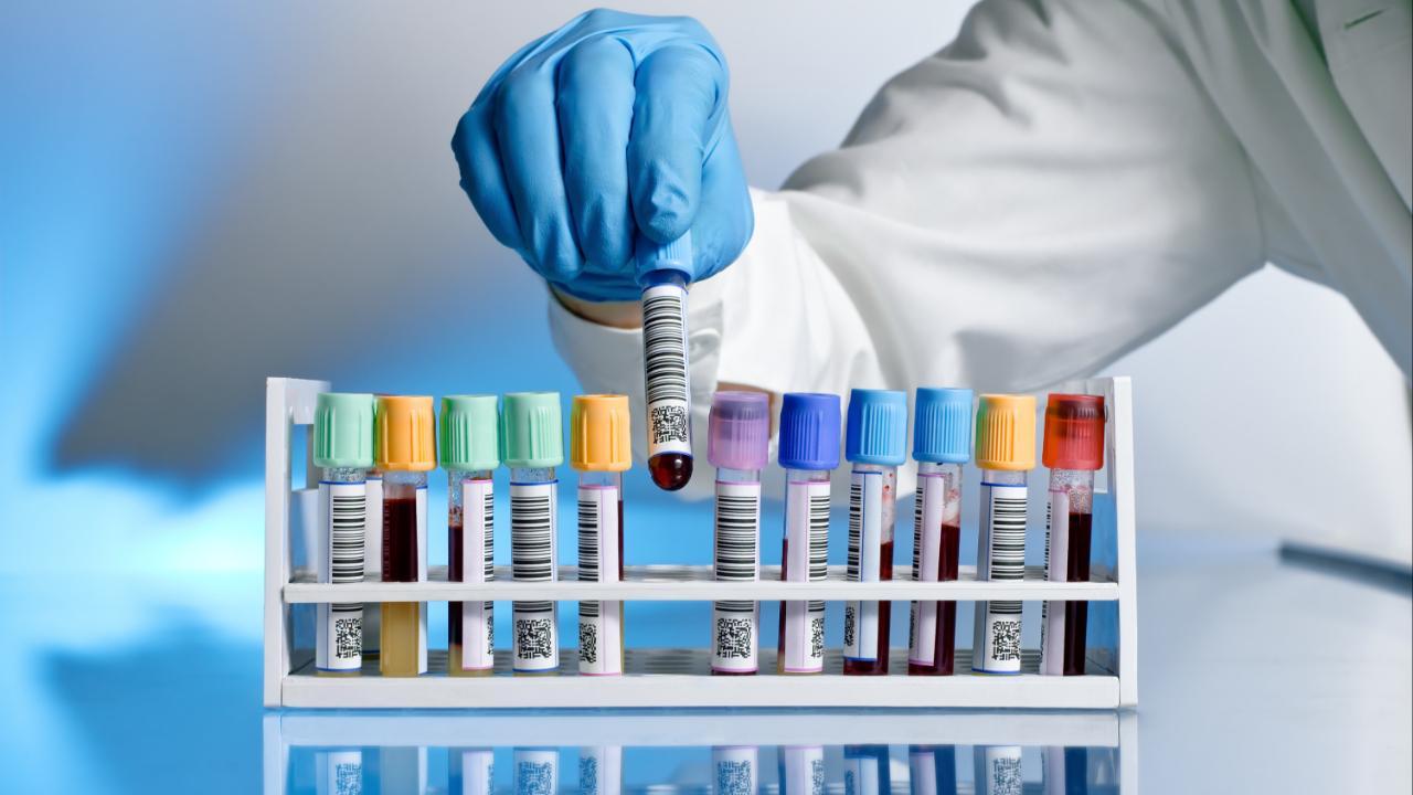 World Health Day 2023: Essential health check-ups and tests that you cannot miss