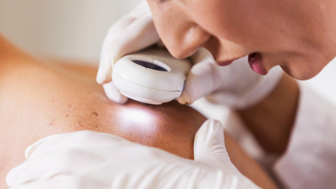 Vitamin D levels may influence body's response to cancer treatment: Study