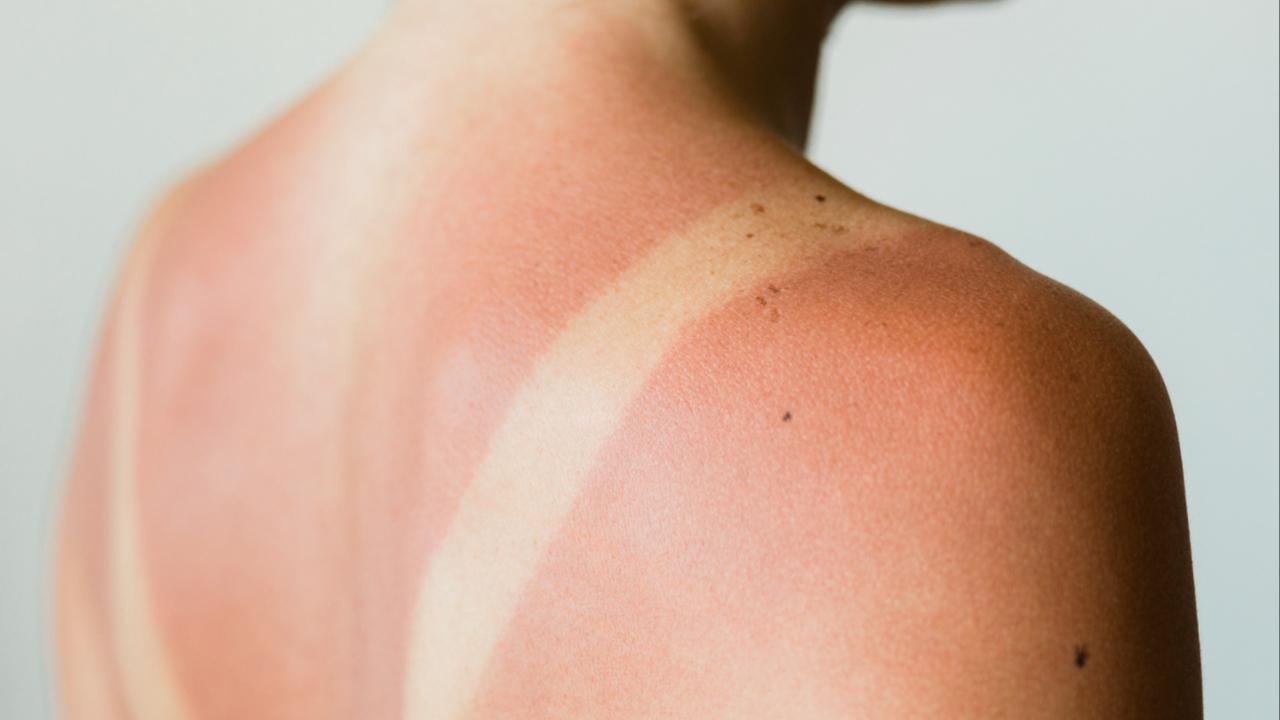 Don't want the sun to get your skin? Here are 10 ways to remove a summer tan