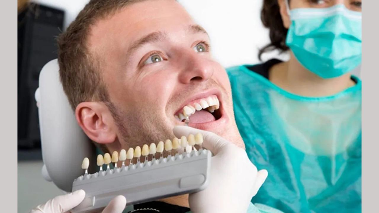 Veneers in Turkey for Quality and Affordability - Enhance Your Smile on a Budget