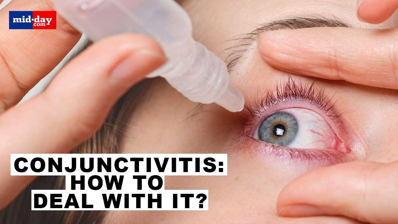 How does Conjunctivitis spread, symptoms and how to prevent it?