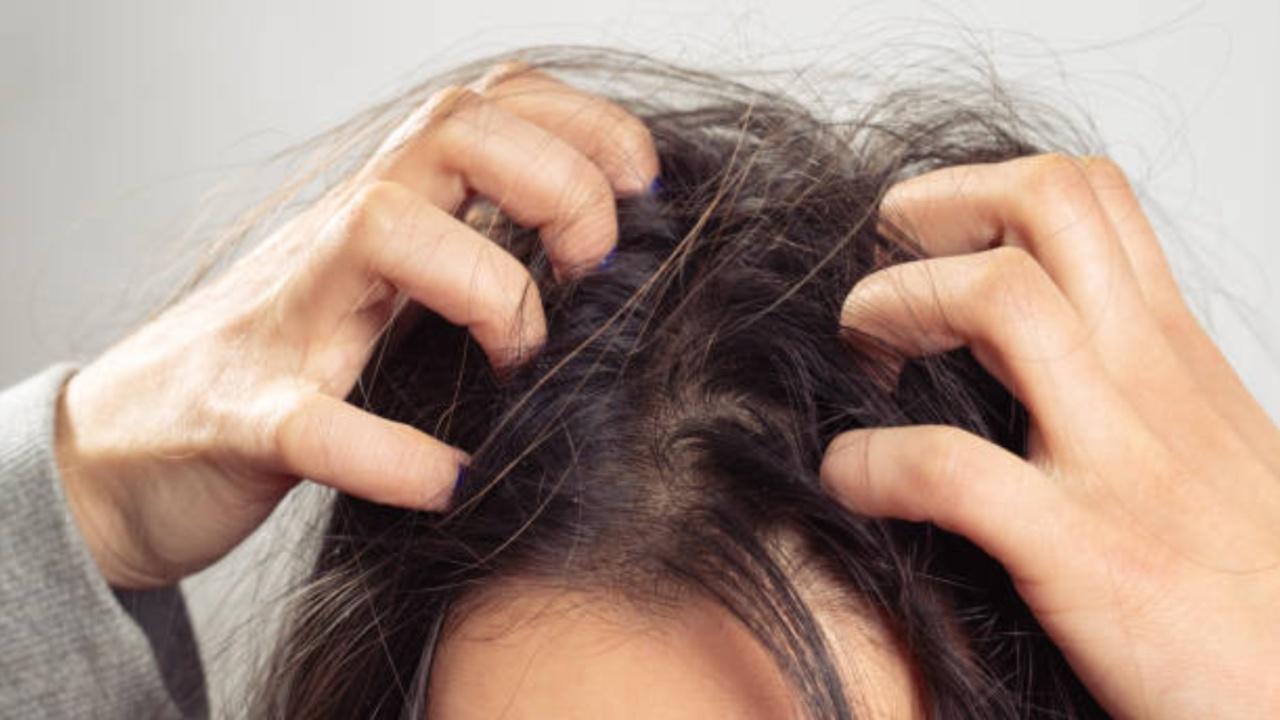 5 haircare products to treat dry scalp