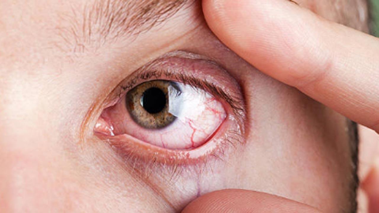 Grandmother 63 gets shades that act as sunglasses tattooed onto her  EYEBALLS  Daily Mail Online