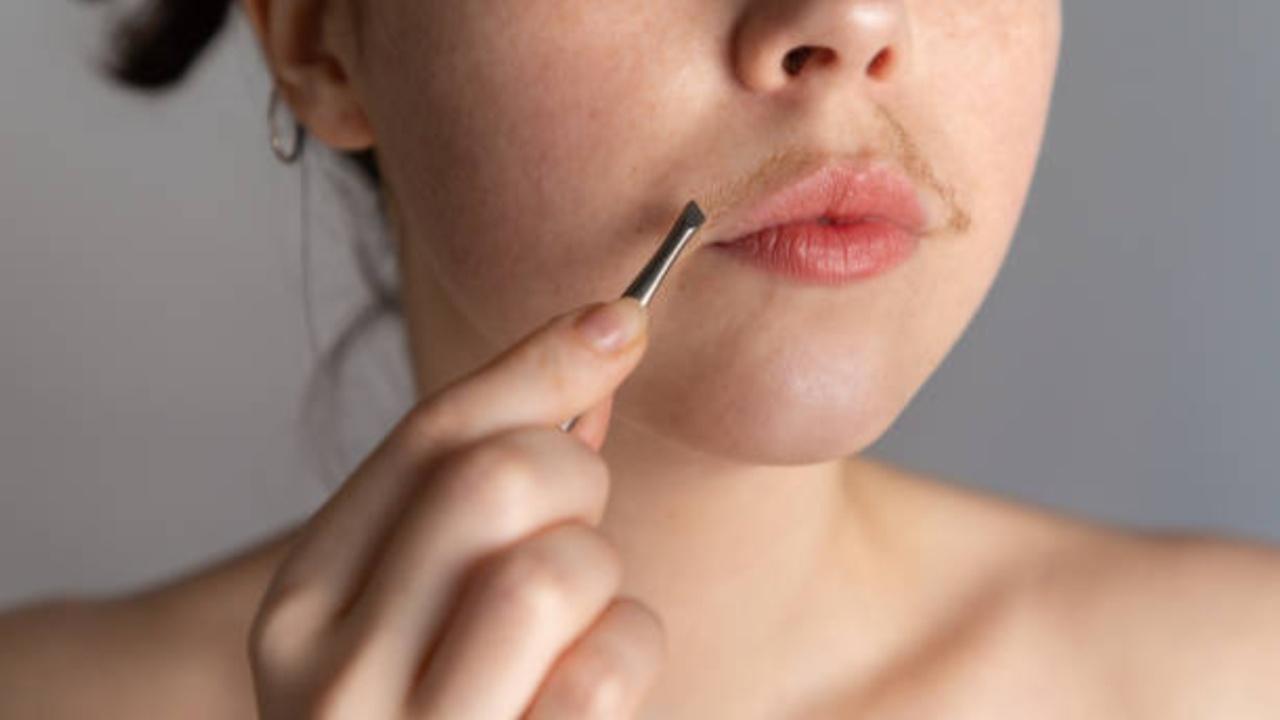 You can try these 5 ways to get rid of upper lip hair naturally. Photo Courtesy: iStock