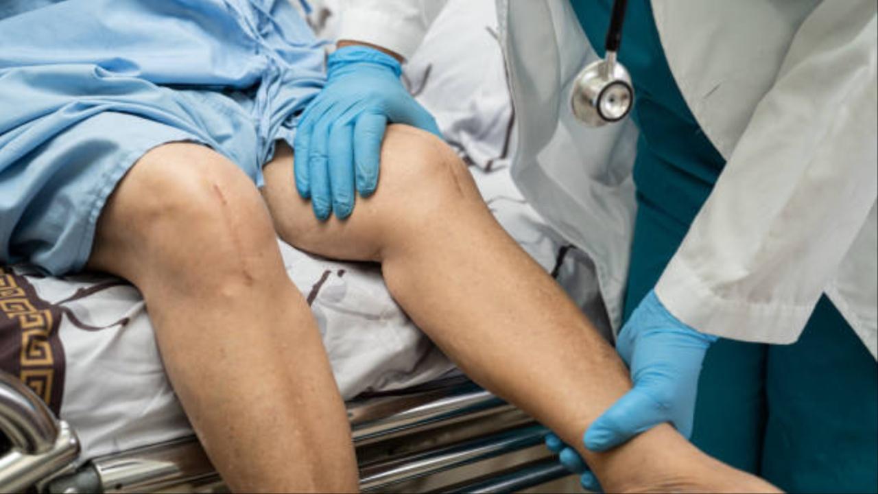 Myth: It won’t let one bend their kneesFact: Advancements in implant design and surgical techniques allow for an excellent range of motion after knee replacement surgery.