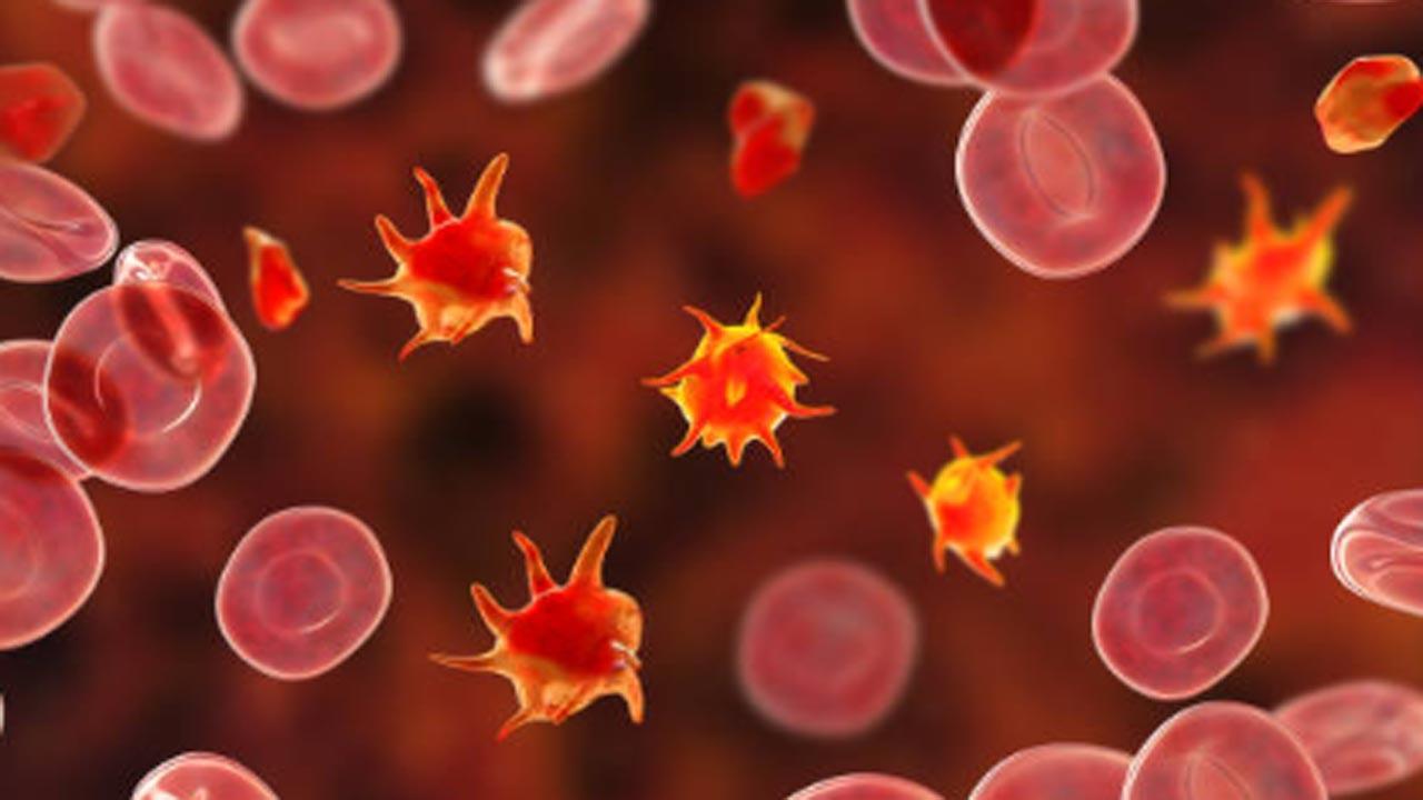 Severe Covid-19 is a thrombotic disease reveals study