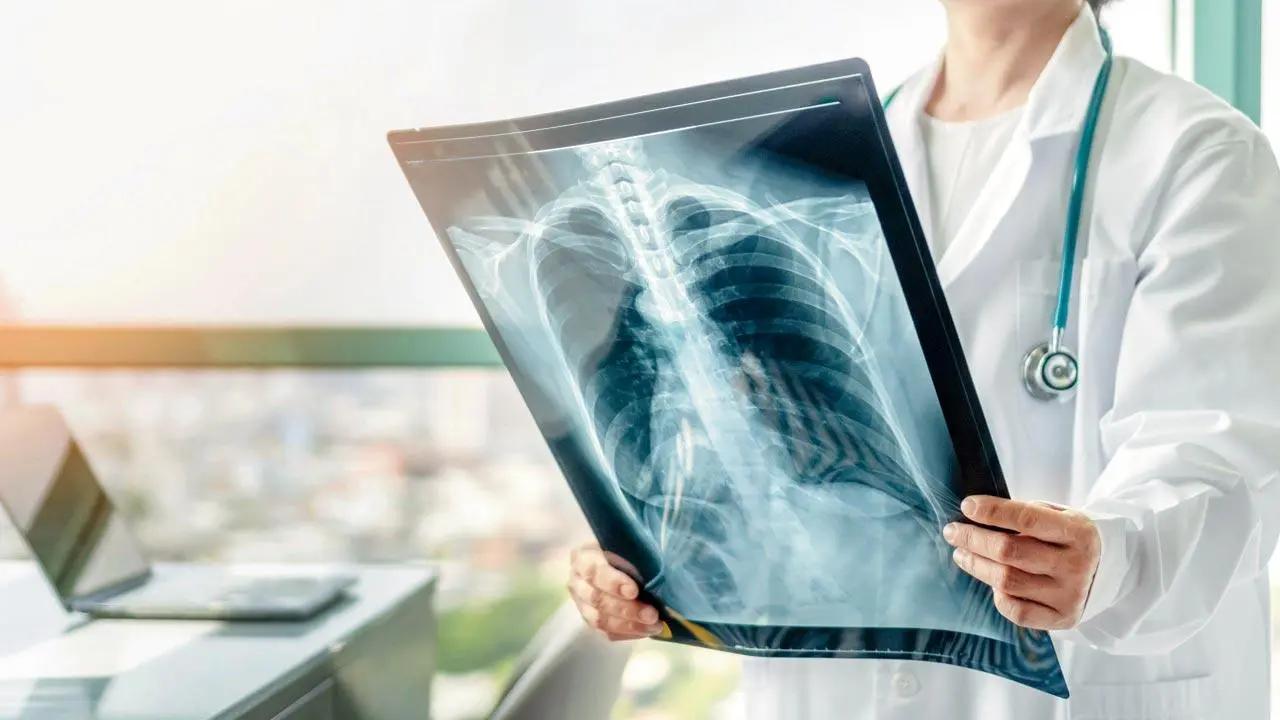 Respiratory problems that threatened lungs in 2023