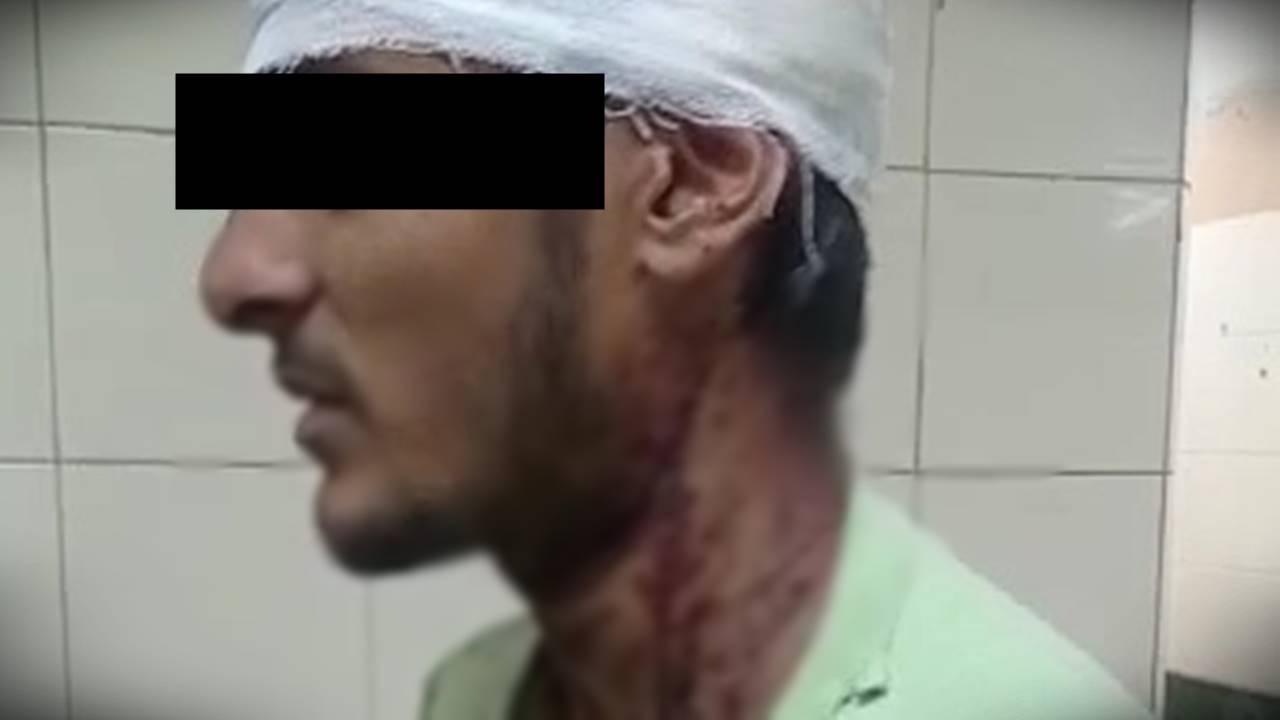 Mumbai: Police booked three for assaulting four students with paper cutter