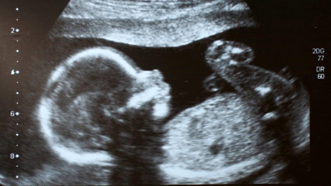 Covid infection could damage foetuses of pregnant women, reveals study