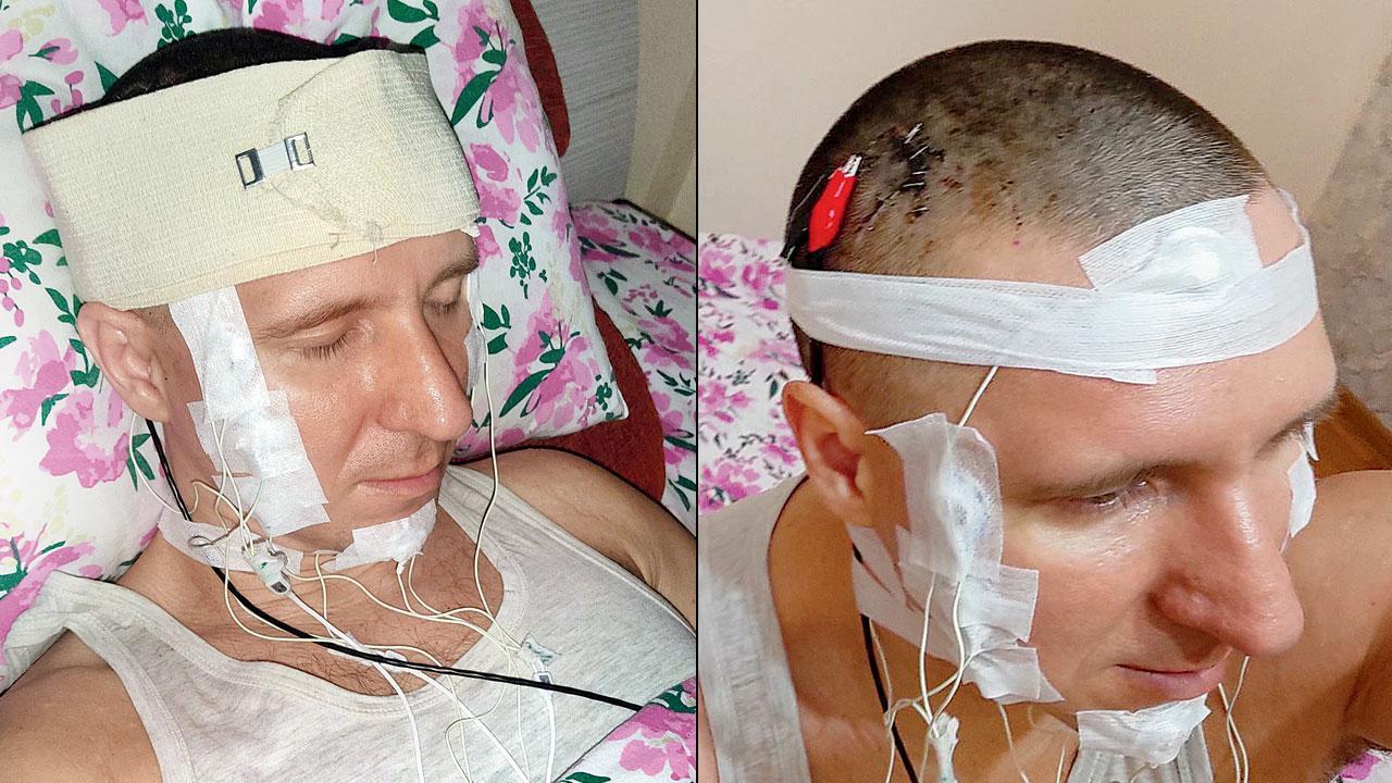 DIY brain surgery?
