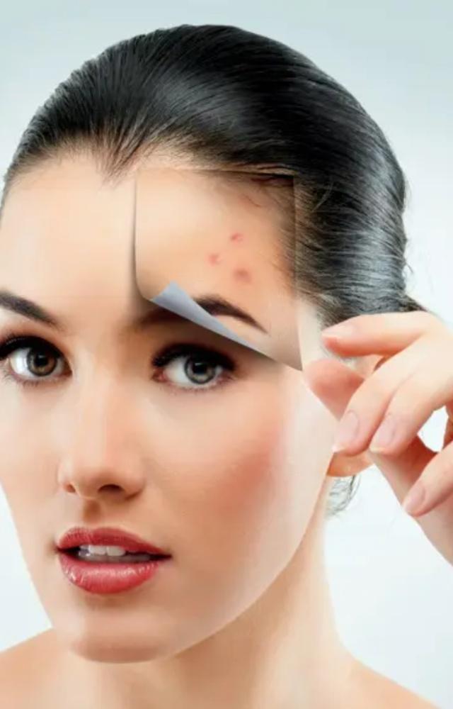 Rice water cleanses pores, balances sebum production, eliminates acne-causing bacteria and drastically reduces the occurrence of acne