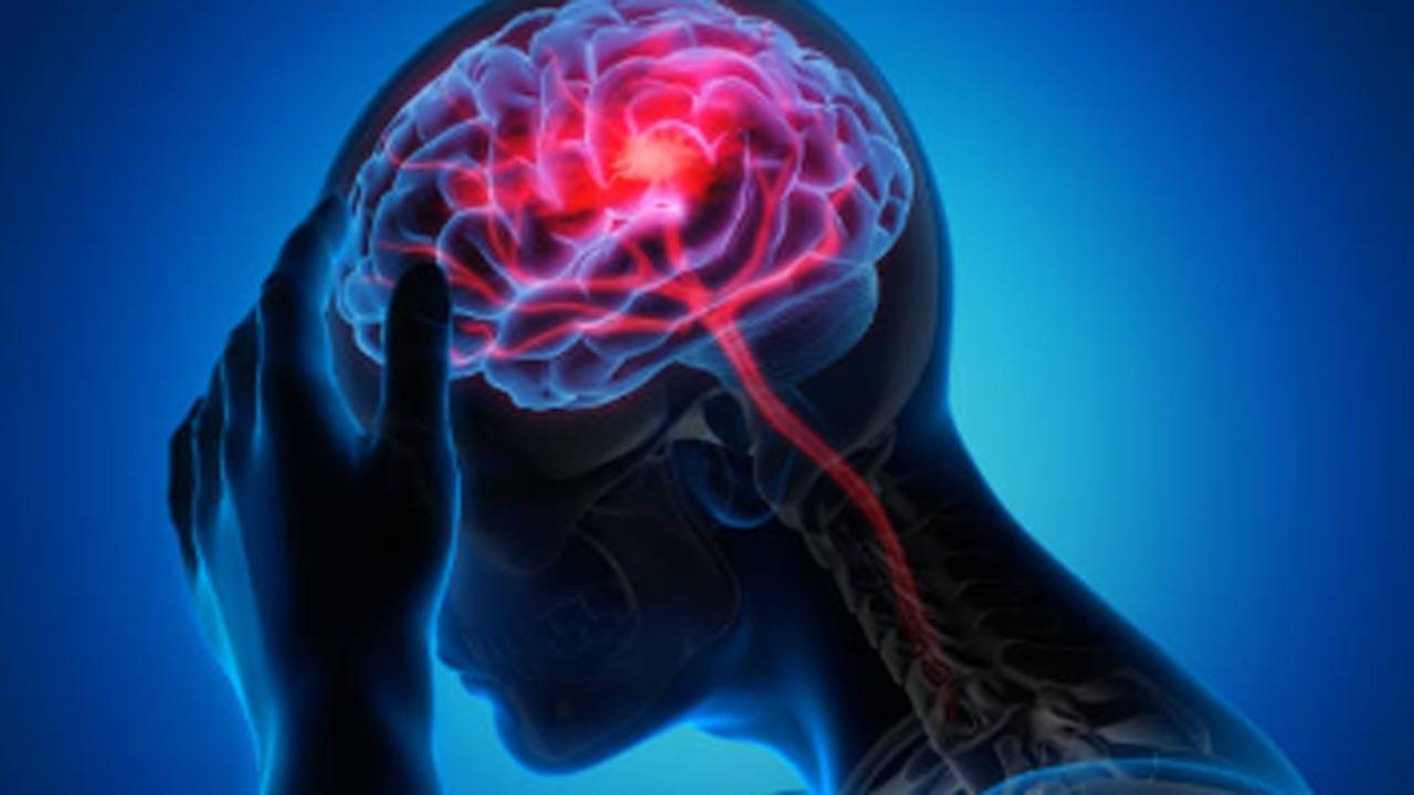 How your brain makes you avoid foods that cause allergy