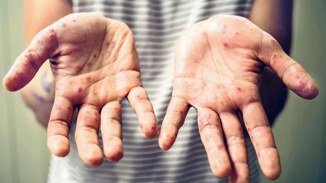 How to protect your little one from 10 common monsoon diseases