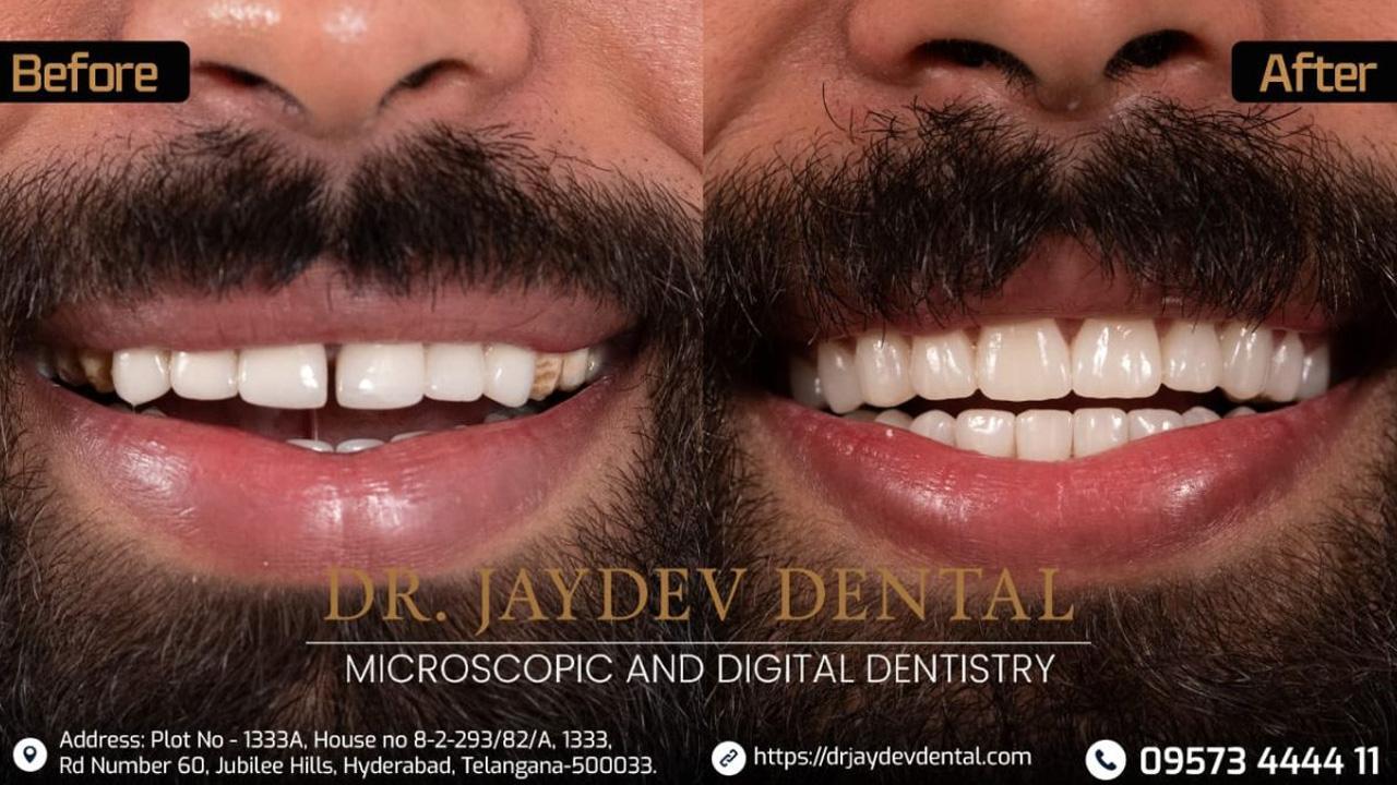Dr. Jaydev Dental: Transforming Smiles and Changing Lives in Hyderabad Using Digital Technology