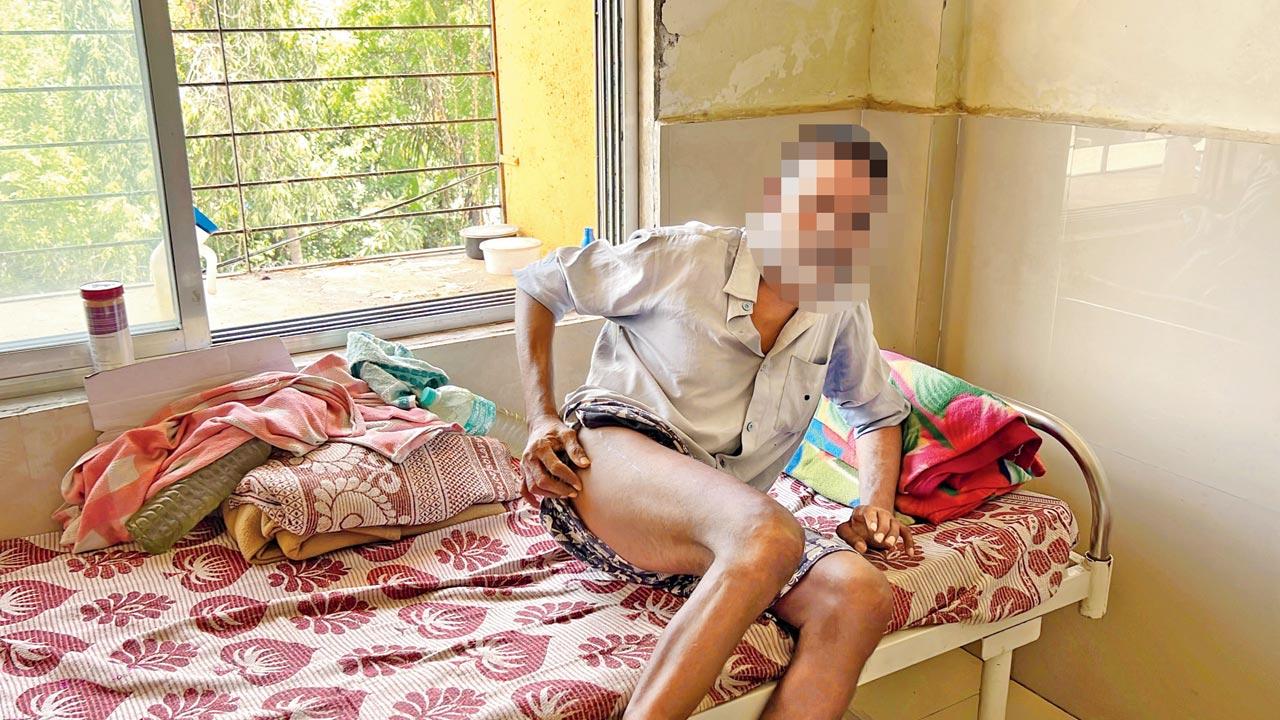 An inmate shows his bruises alleging he was beaten up. Pics/Hanif Patel