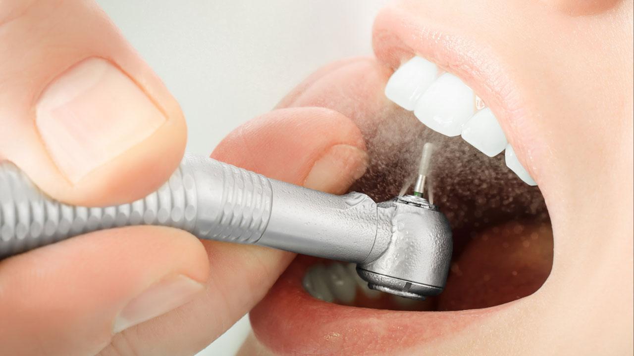 Can dental cleaning damage your teeth and gums?