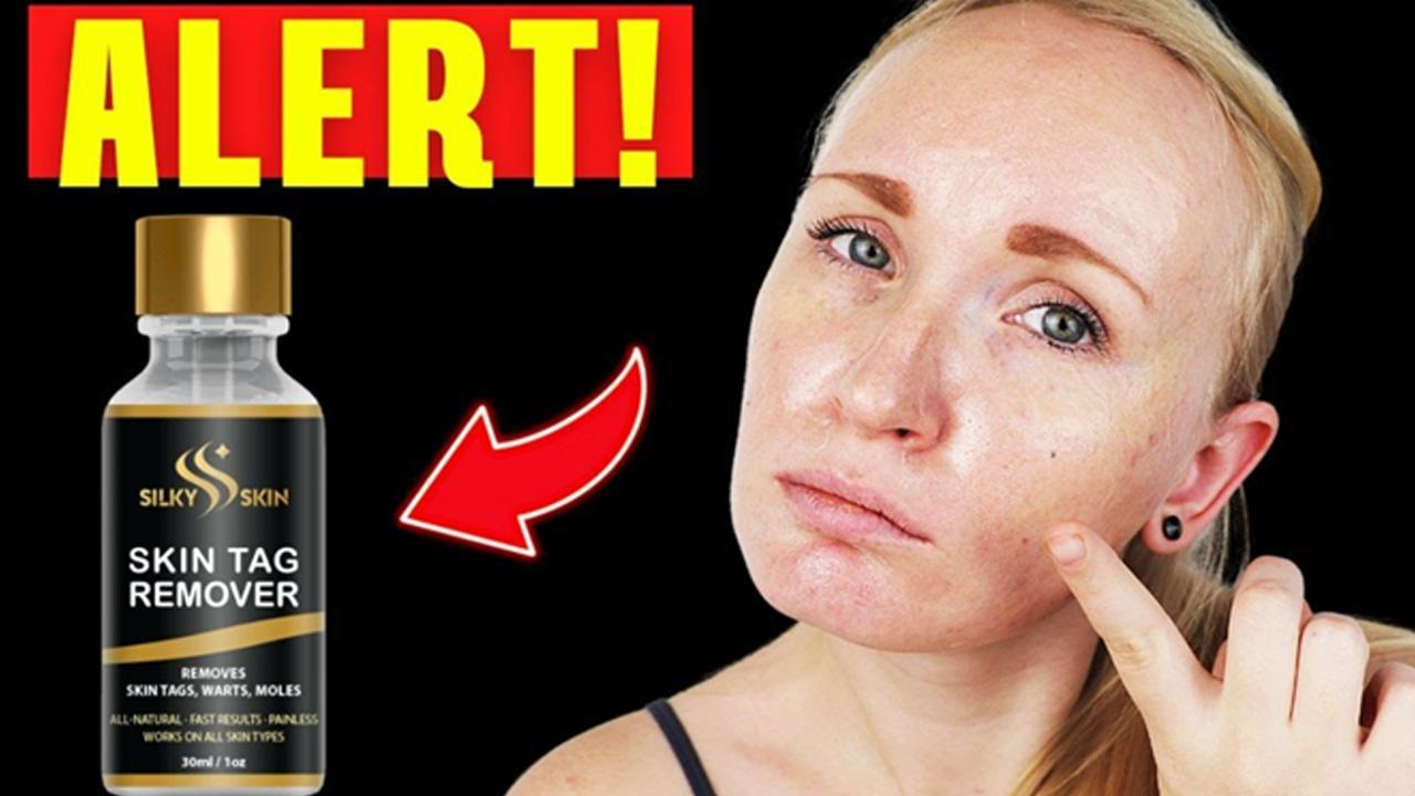 Flawless Skin Tag Remover Reviews (Paradise Skin Tag Remover) Scam Or