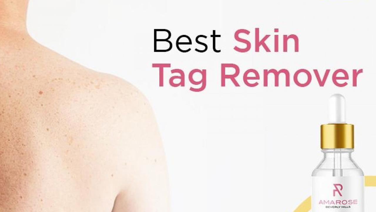 The Best Skin Tag Removers