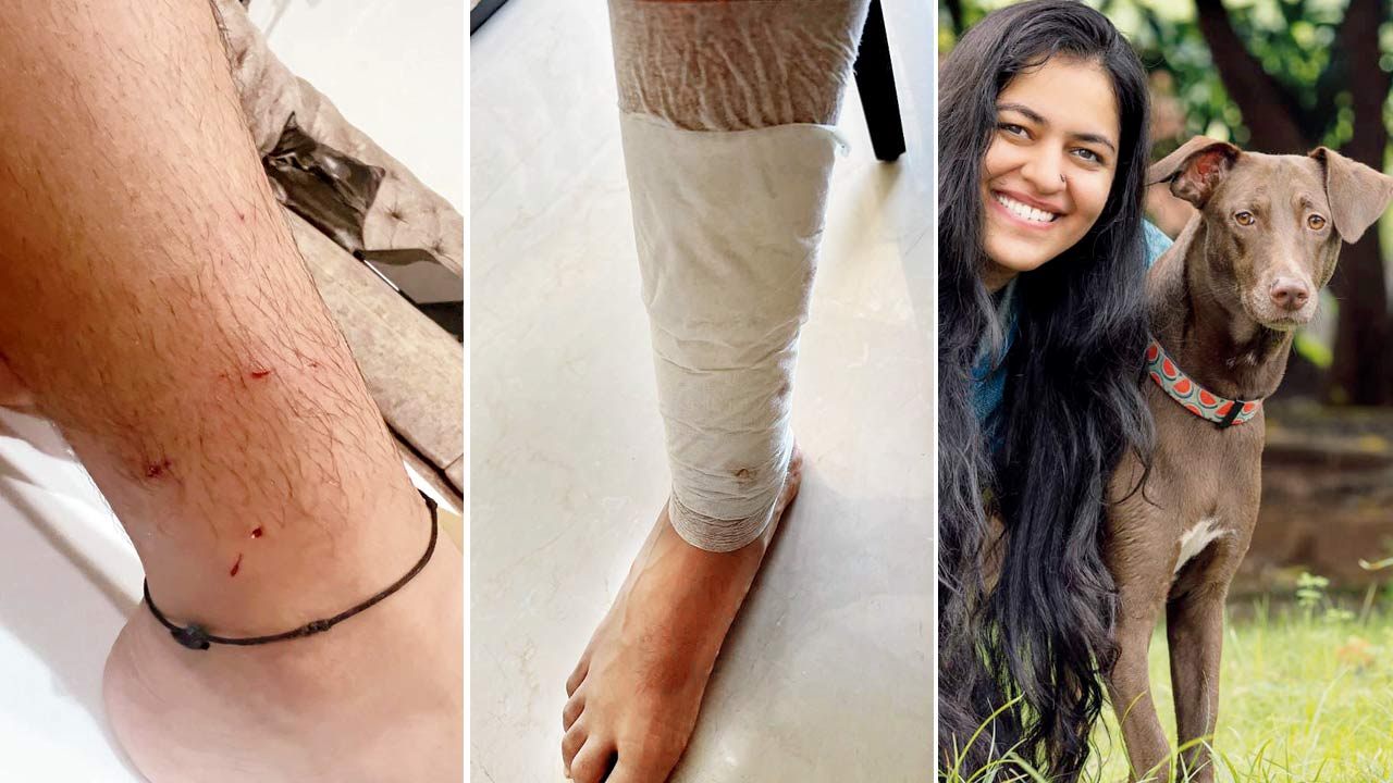 Bite marks on Siddhant Gupta’s legs; (right) Varuna Kaur, canine behaviourist and trainer
