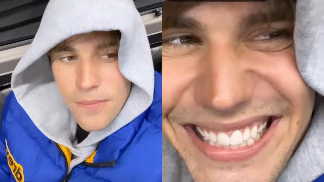 Justin Bieber opens up about his battle with partial facial paralysis