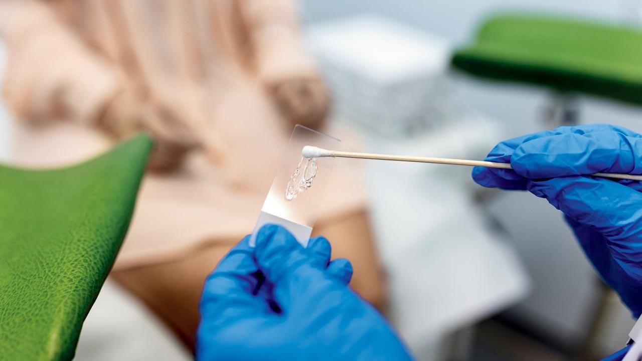A vaginal swab is taken and the smear is tested for the cancer-causing HPV strain during a Pap smear test
