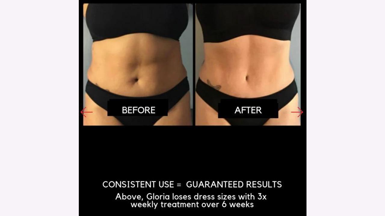 Led Lipo Light Therapy Reviews Shelly Lighting