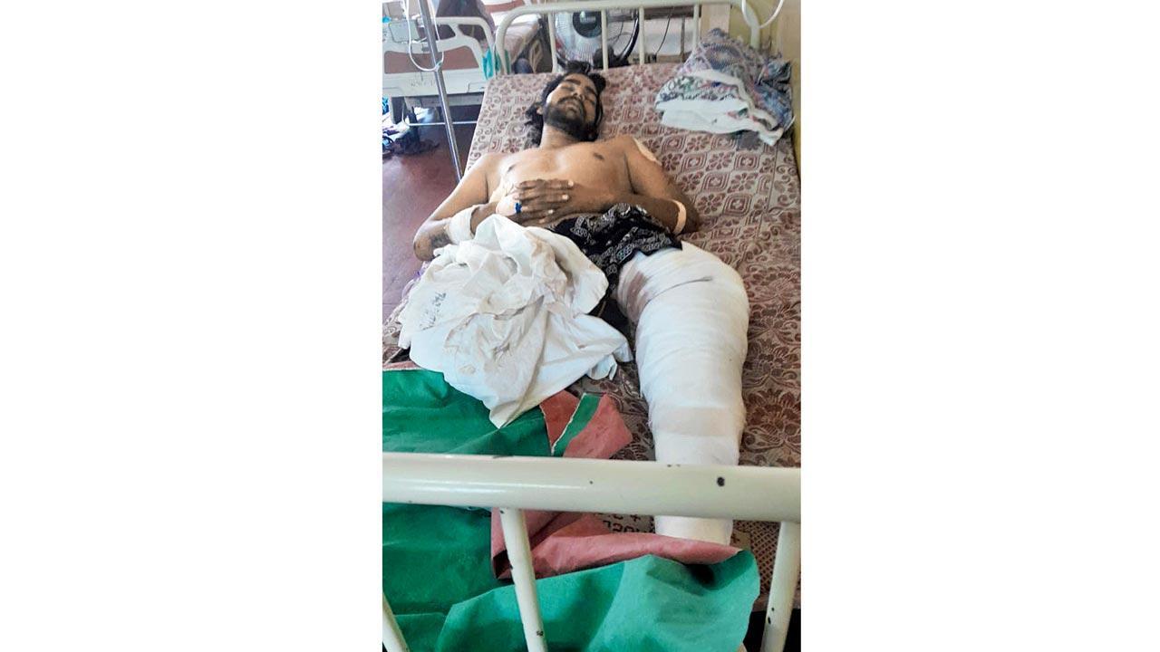 Mumbai: 25-year-old loses leg trying to board running train