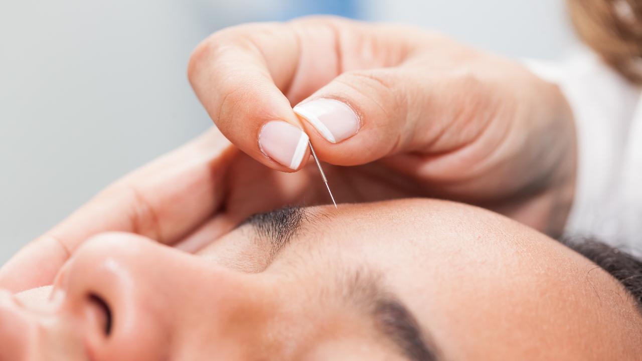 What you need to know about acupuncture and how it can help with hypertension