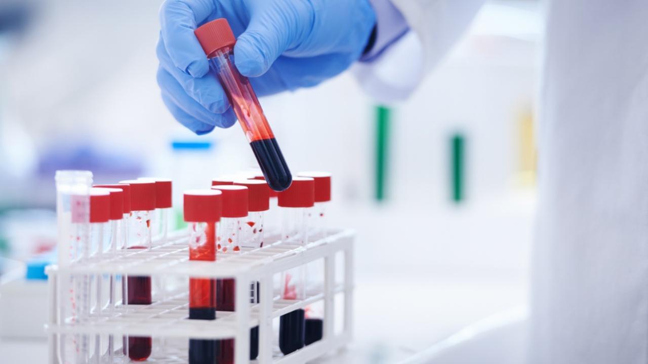 Blood samples can help predict kidney diseases in type 2 diabetes patients: Study