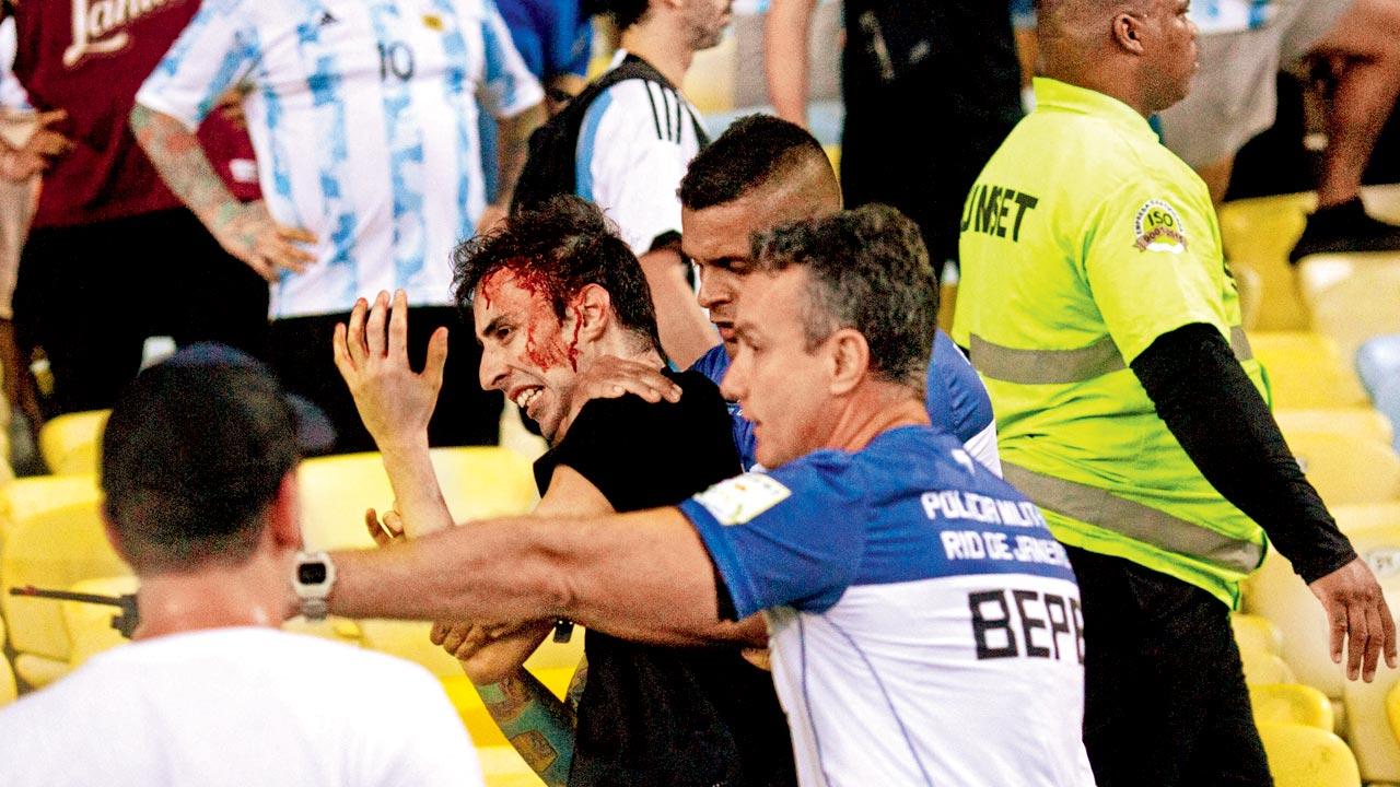 A profusely bleeding fan is removed by police officers after clashes involving Brazil and Argentine fans 