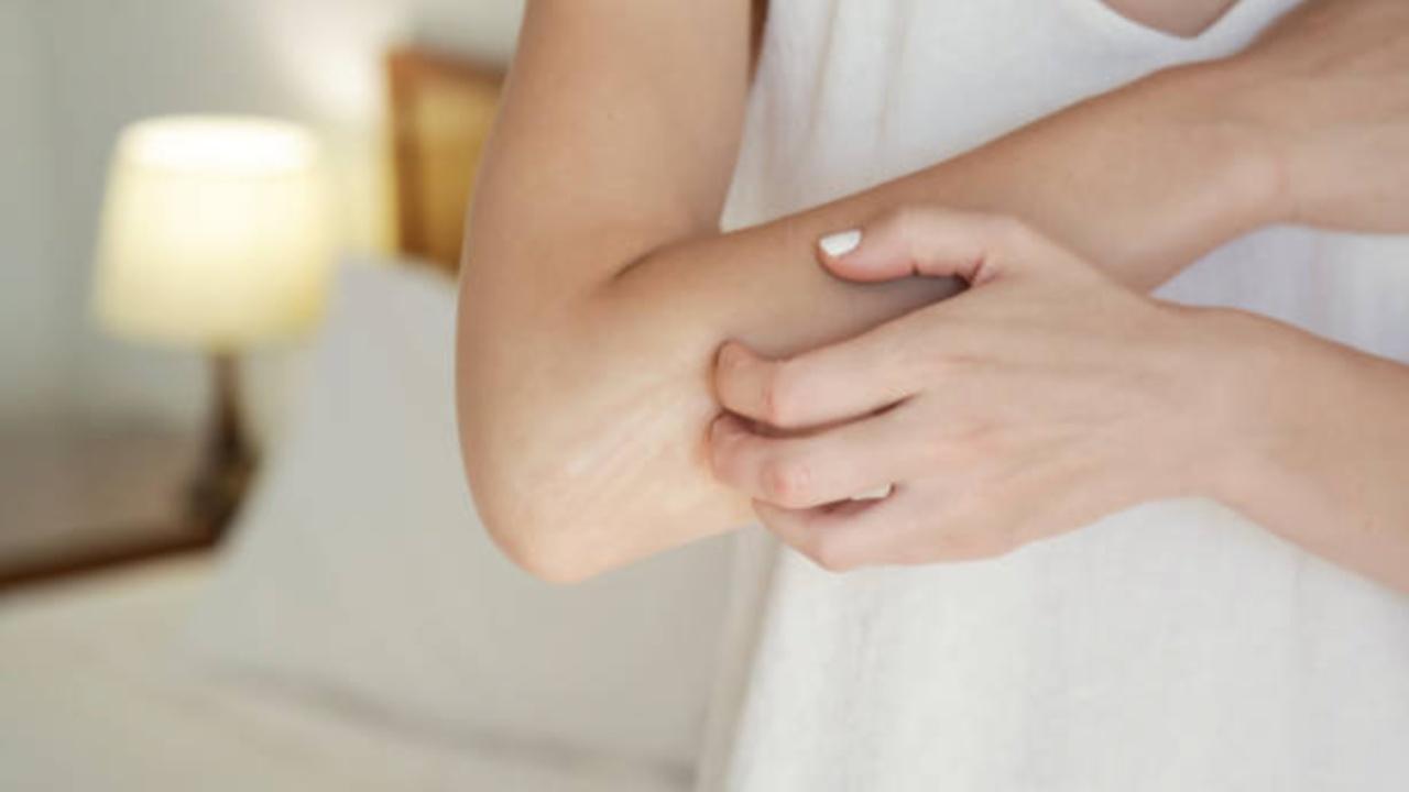 Study finds common skin bacterium that causes persistent itching