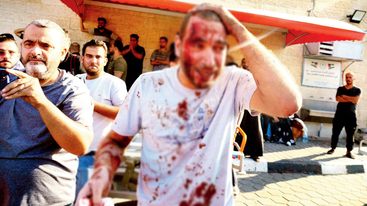 A Palestinian wounded in an Israeli air strike on Gaza Strip arrives at al-Aqsa Hospital in Deir el-Balah City, Gaza Strip, on Saturday. Pic/AFP