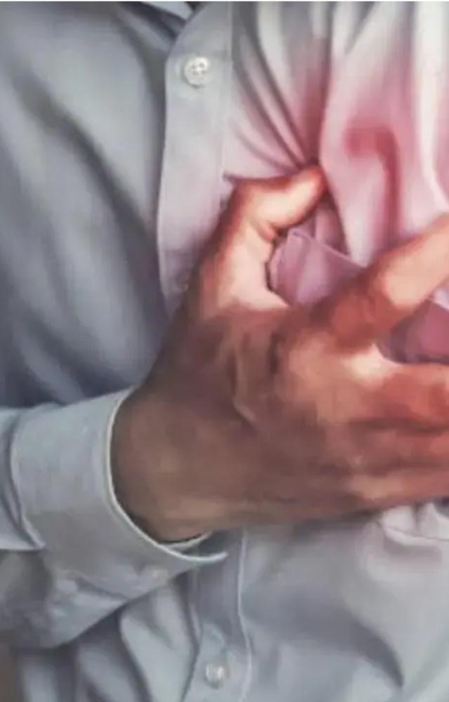 Five things to know about heart attacks