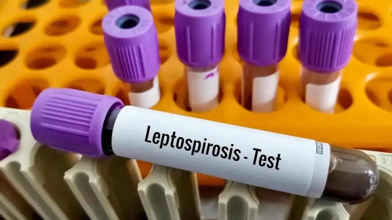 Leptospirosis: Mumbai reports 94.93 pc of cases in Maharashtra this year