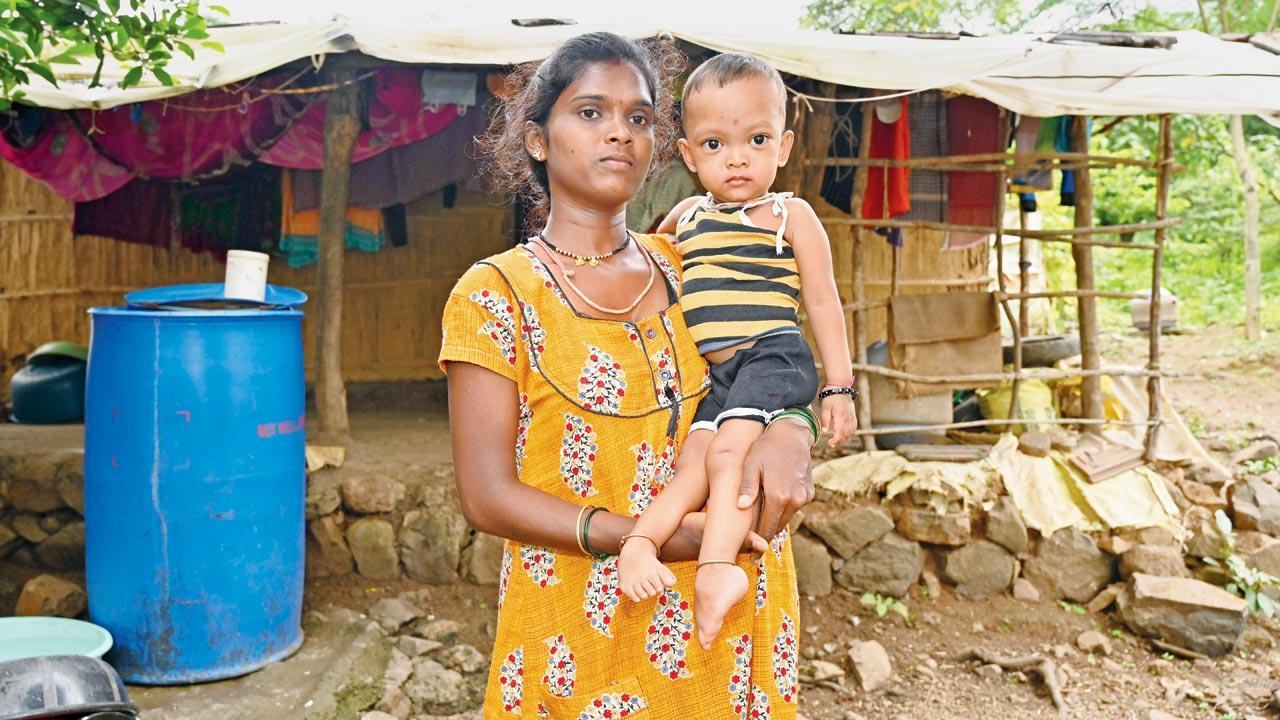 Nisha Sapta with her son Tanish Sapta, who has a congenital limb defect. While he has been diagnosed with severe acute malnutrition, his parents weren’t aware of this, until a local NGO pointed it out  