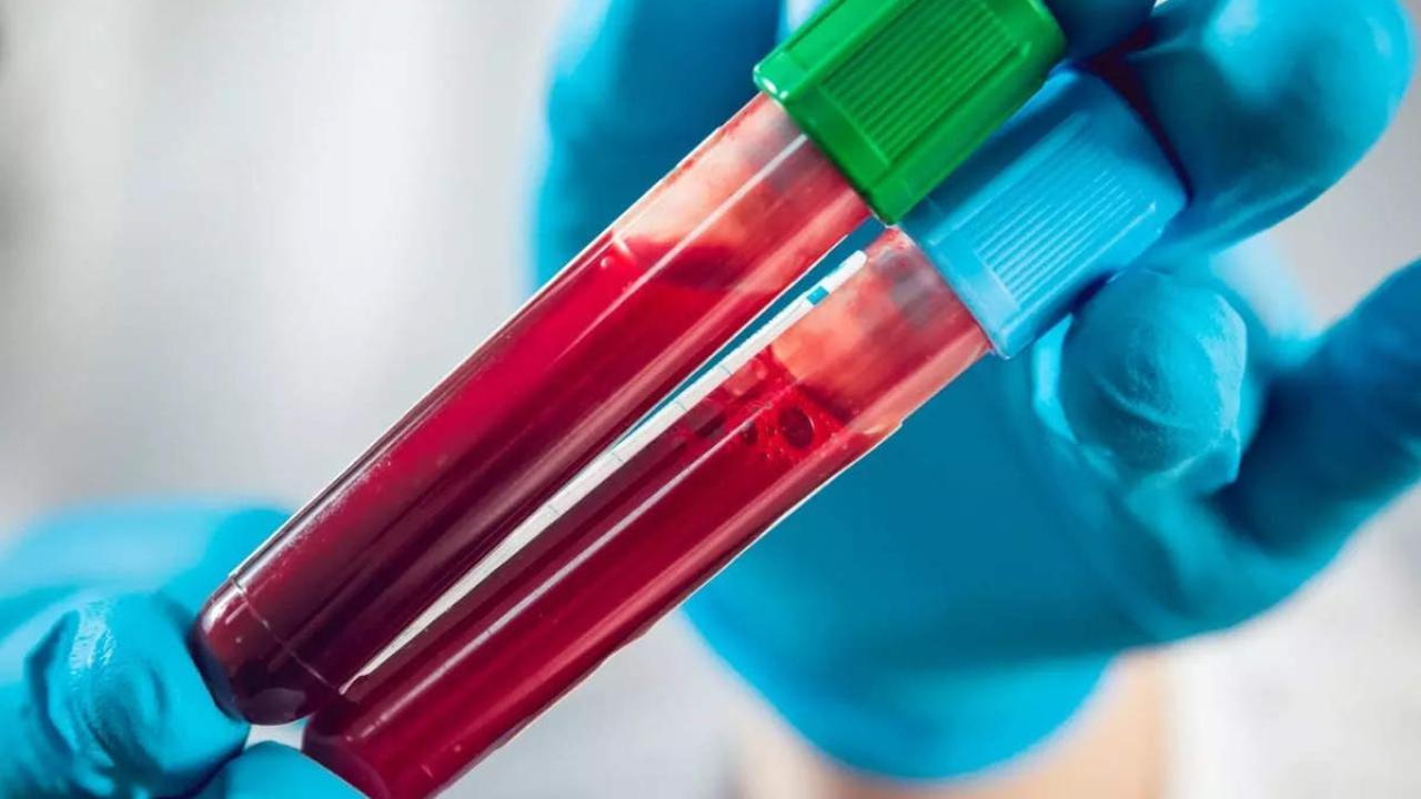 Lucknow: KGMU study identifies new blood marker