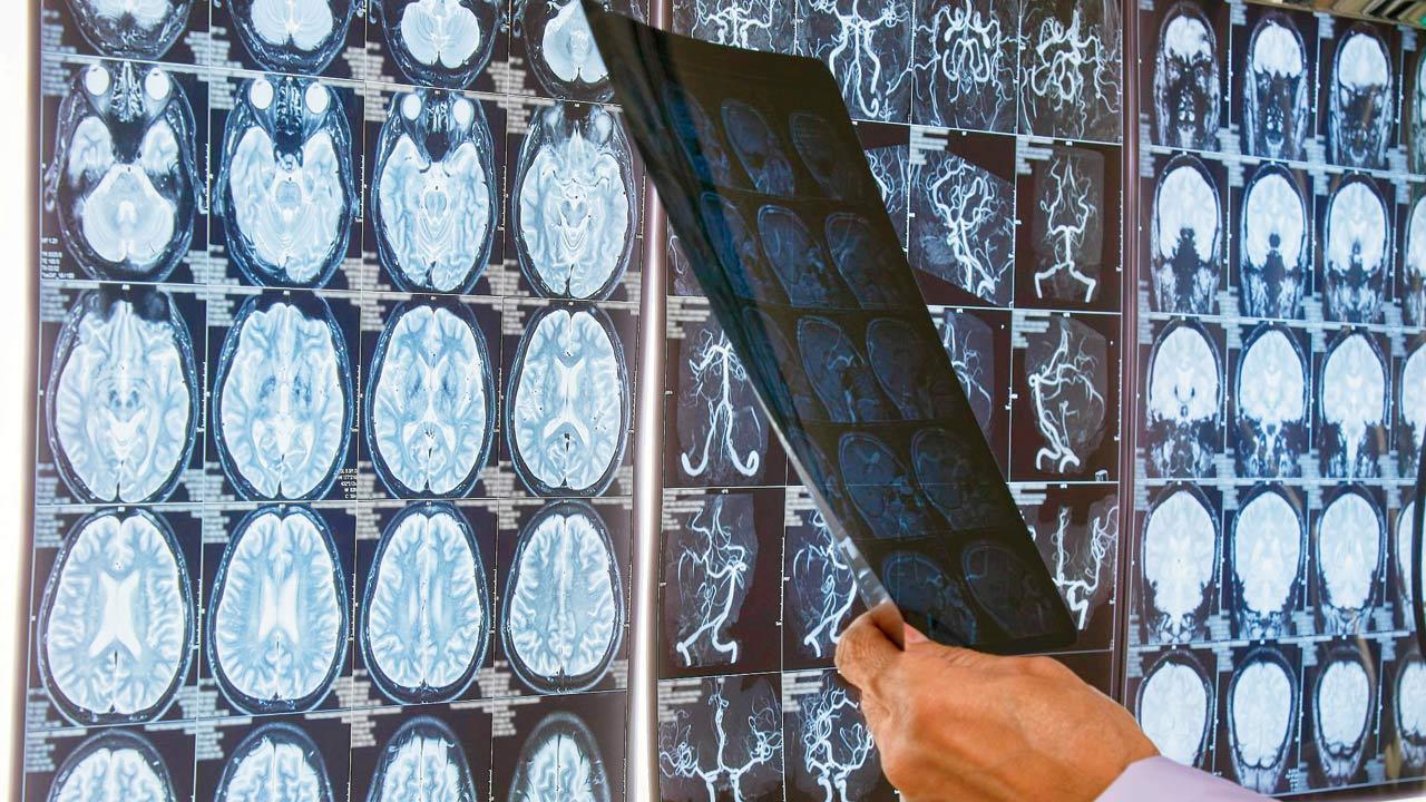 Lancet lists 14 risk factors for dementia