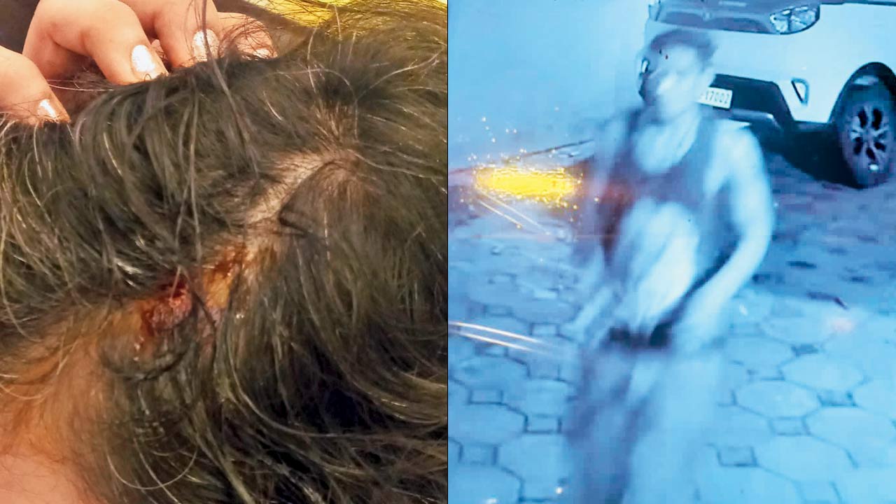 The injury caused to the doctor (right) the burglar spotted in the CCTV