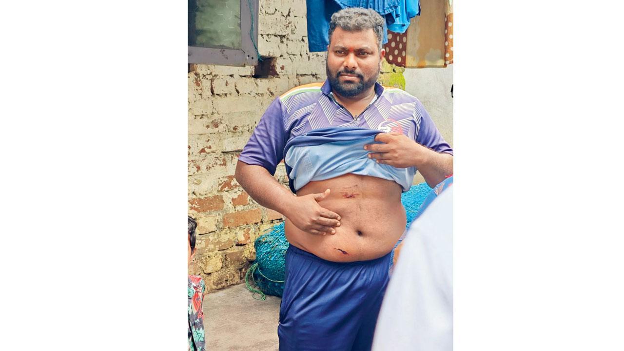 Dog bites 28 in Virar near Mumbai, civic body launches search