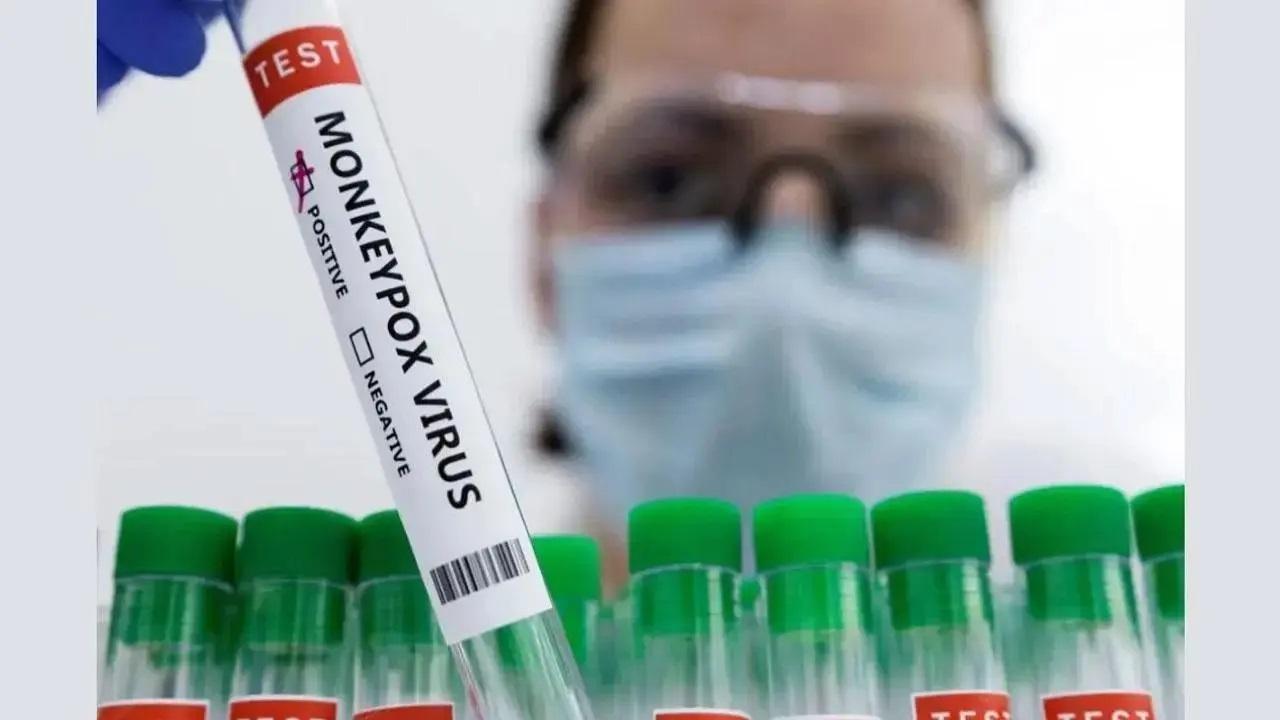 Expert urges health officials to begin screening for Mpox at airports in India