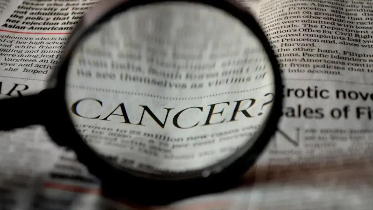 Doctors flag concerns on rising colon cancer cases among adults under 50